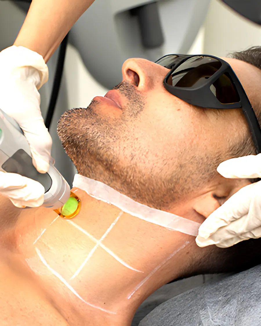 Advanced Laser Hair Reduction Technology at Cinch Clinics